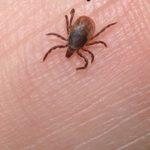 Tick Borne ‘Powassan Virus’ Is Worse Than Lyme Disease